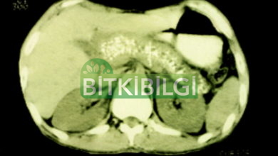 Photo of Karaciğer ve Pankreas Hastalıklarında Sıvı Propolis